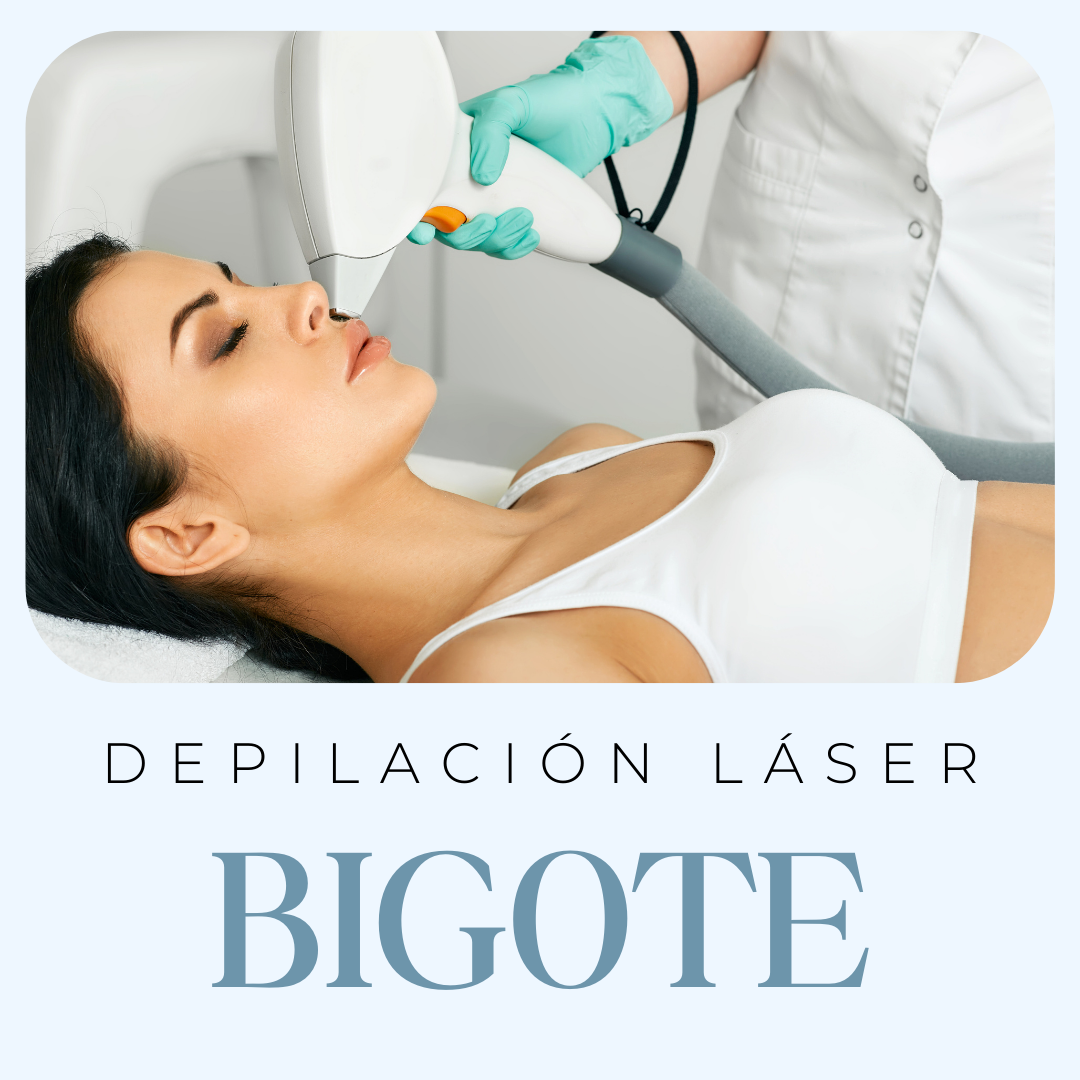 Depilacion Laser Bigote