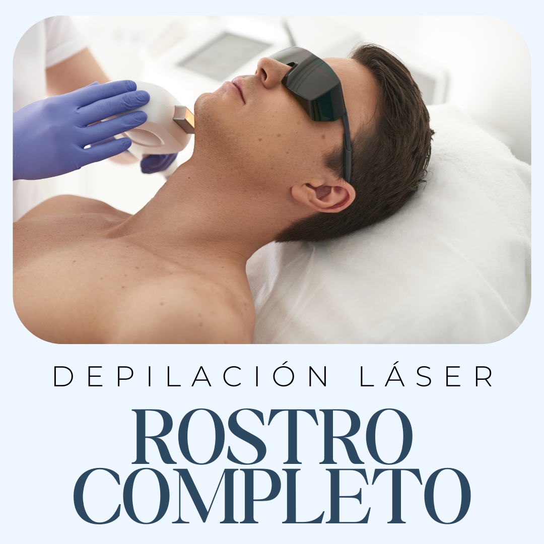 Depilacion Laser ROSTRO COMPLETO PARA EL
